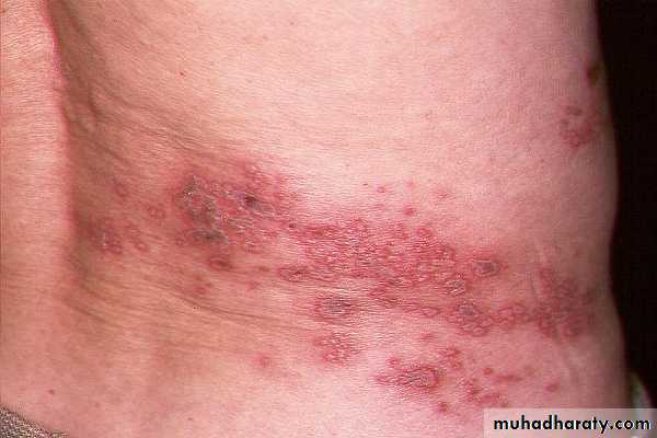 Dermatology sessions