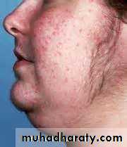 Endocrine