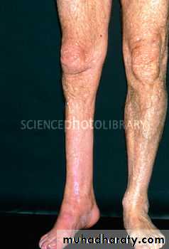 Endocrine