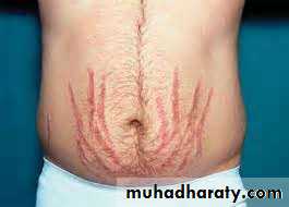 Endocrine
