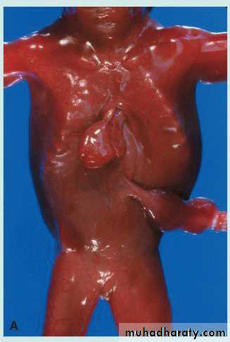 Body Cavities