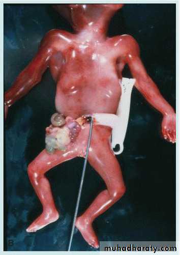 Body Cavities