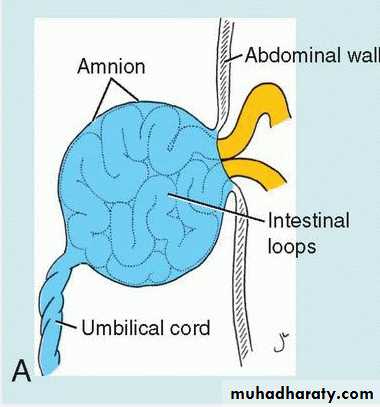 Body Cavities