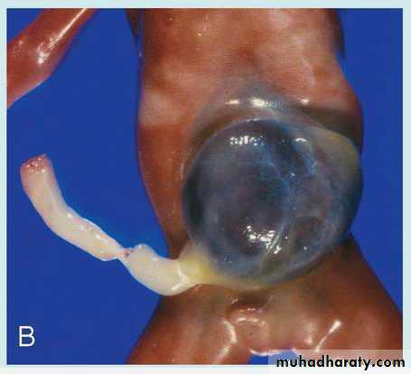 Body Cavities