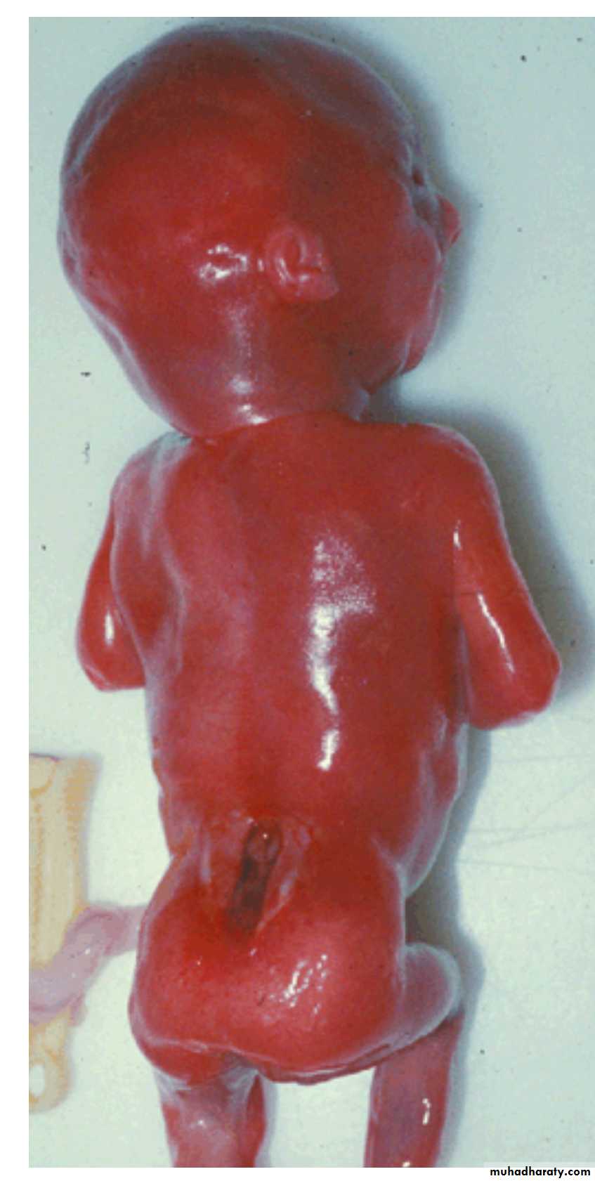 NeuroEmbryology
