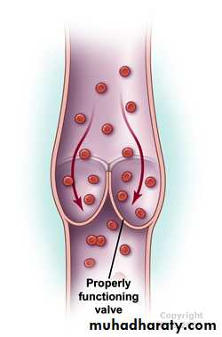 Peripheral Vascular Diseases
