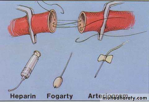 Peripheral Vascular Diseases