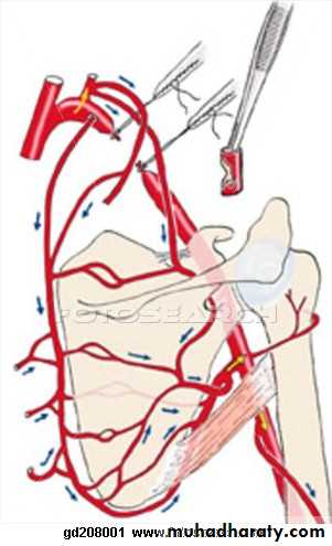 Peripheral Vascular Diseases