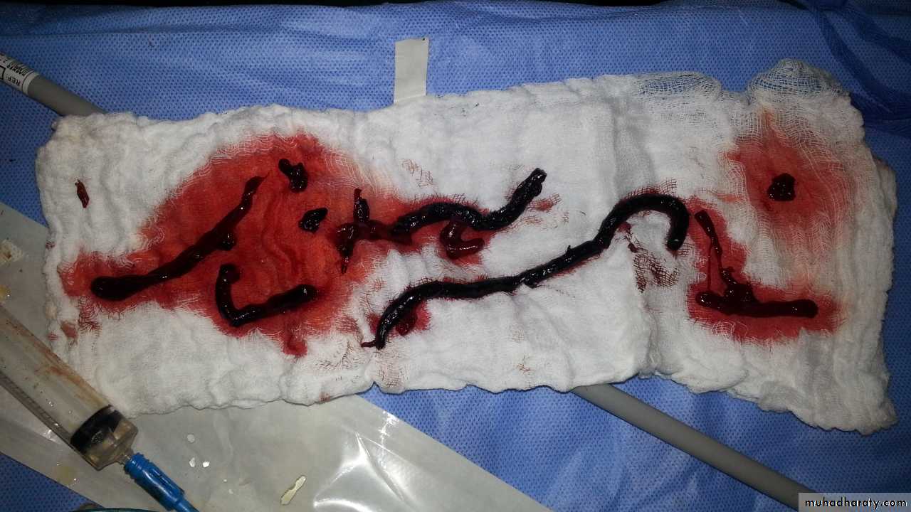 Peripheral Vascular Diseases