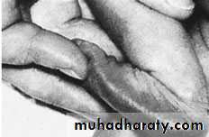 foot and ankle deformity