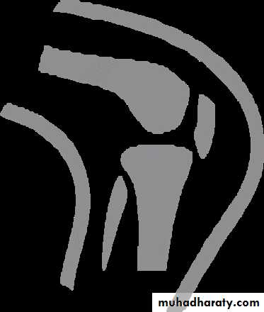 foot and ankle deformity