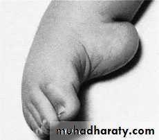 foot and ankle deformity
