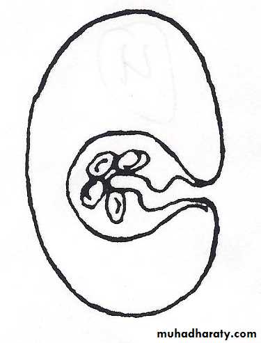 cestodes