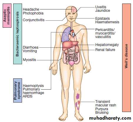 leptospirosis