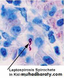 leptospirosis