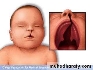 Infection in immuncompromized patient