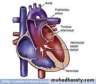 Infection in immuncompromized patient