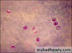 Infection in immuncompromized patient
