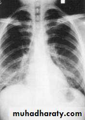 Infection in immuncompromized patient