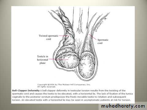 Scrotal Pathologies
