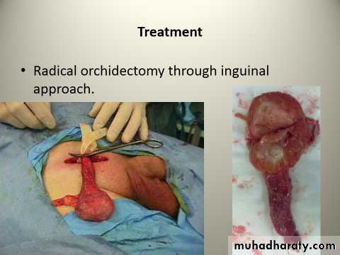 Scrotal Pathologies