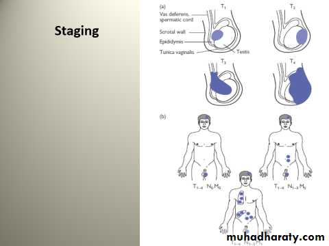 Scrotal Pathologies