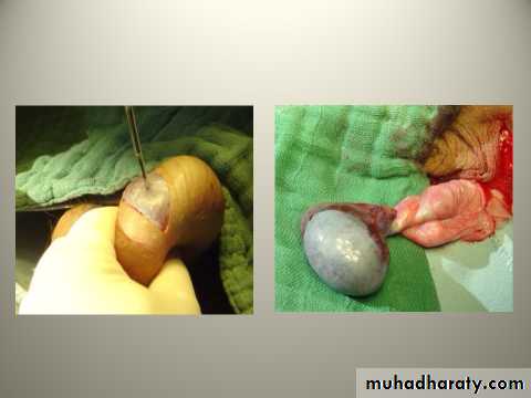 Scrotal Pathologies