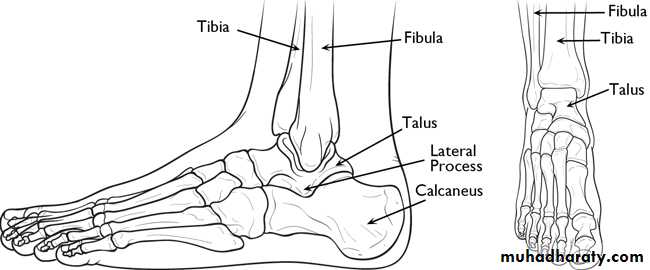 Fracture Talus