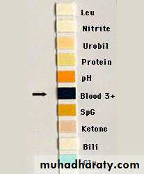 Anemia