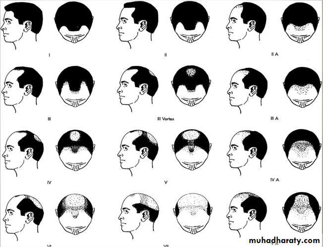 hair disorder