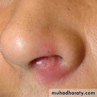 نماذج اسئلة عملي