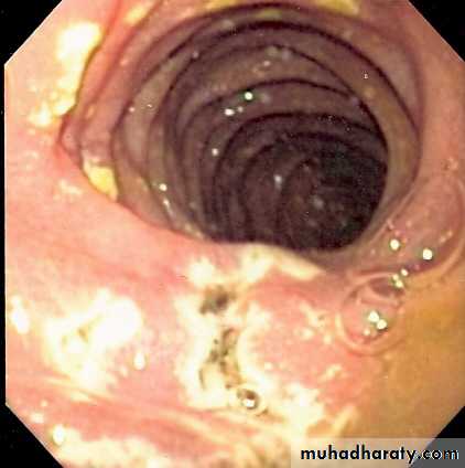 Digestive sys theory