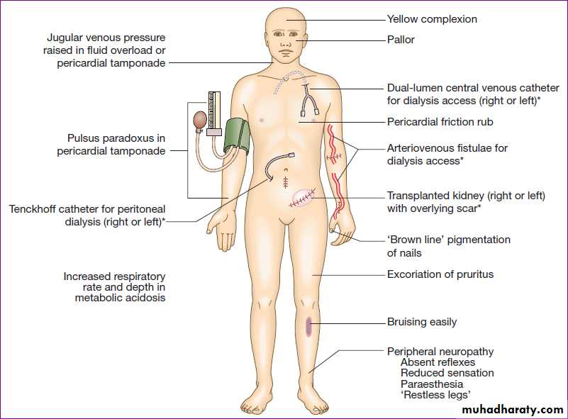 Renal