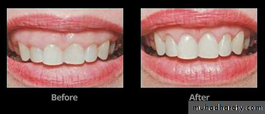 terminology