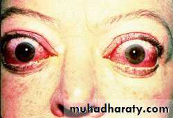 Thyroid disorders