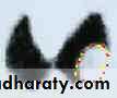 Thyroid disorders