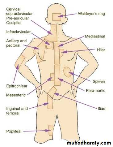 leukemia and lymphoma