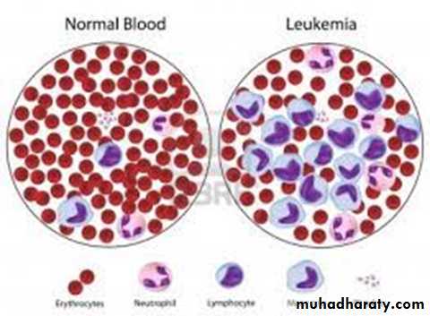 leukemia and lymphoma