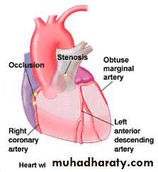 cardiac surgery