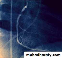 cardiac surgery