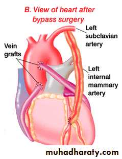 cardiac surgery