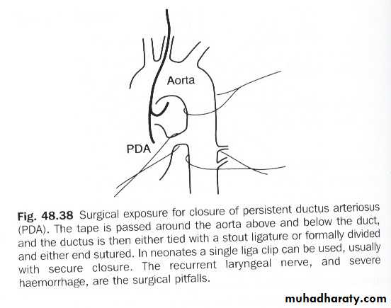 cardiac surgery