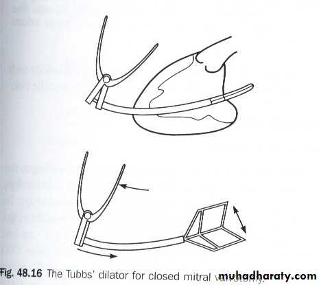 cardiac surgery