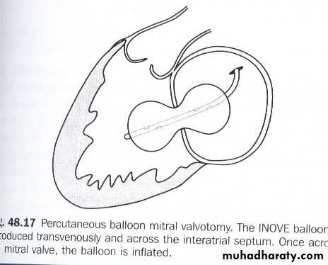 cardiac surgery