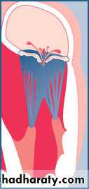 cardiac surgery