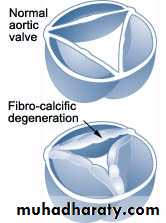 cardiac surgery
