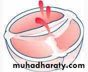 cardiac surgery