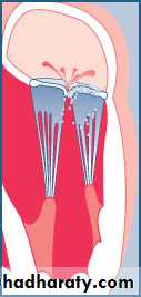 cardiac surgery