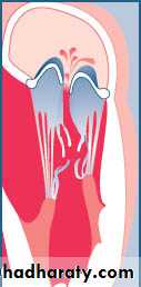 cardiac surgery