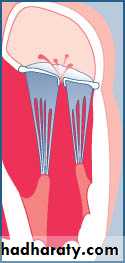 cardiac surgery